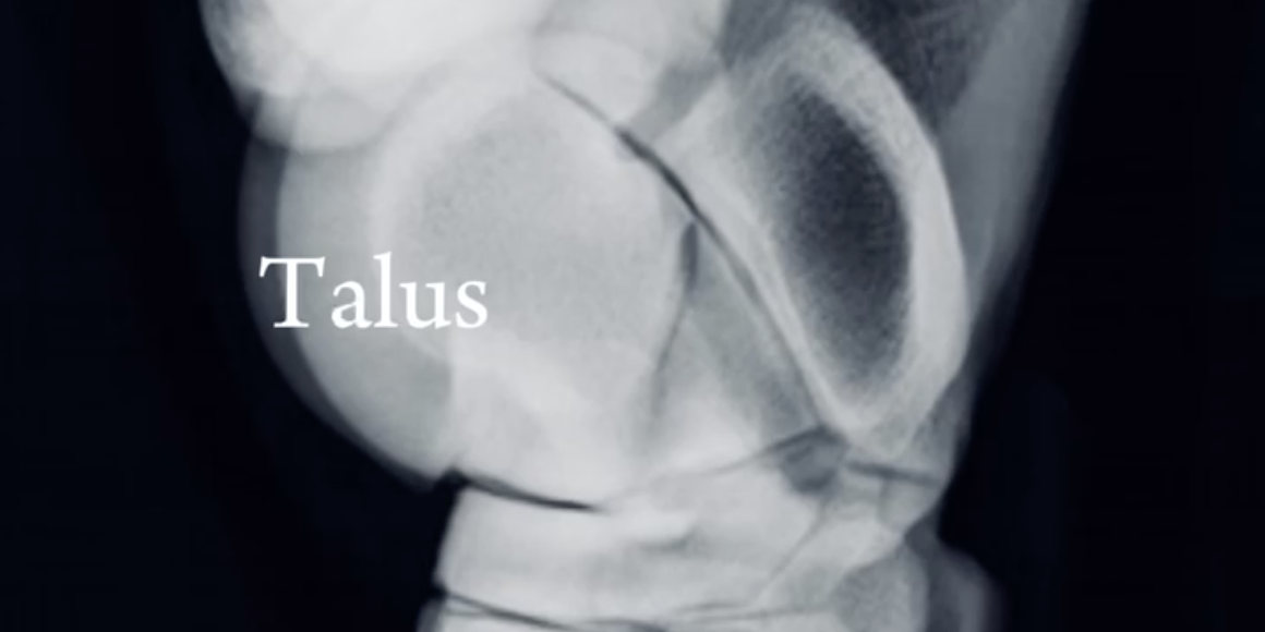 Toma radiográfica del tarso latero- medial